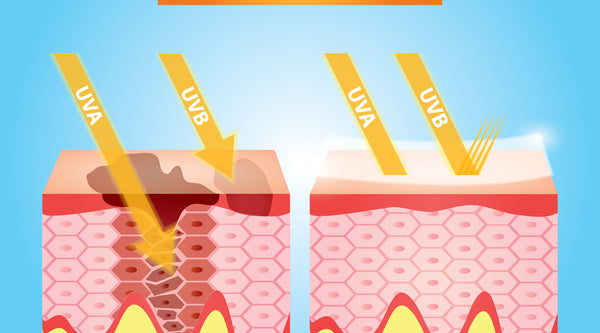 Image Showing How UV Rays Affect Skin - Vu Skin System