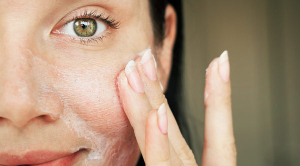Woman cleansing face to prevent acne - Vu Skin System